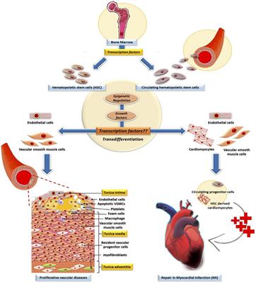 Hematopoietic Stem Cell Transcription Factors in Cardiovascular Pathology